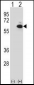 GOPC Antibody (C-term)