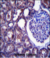 NPC1 Antibody (Center)