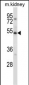 ULK3 Antibody (C-term)