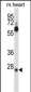 SFRS2B Antibody (N-term )