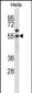 FOXN4 Antibody (N-term)