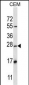 D4S234E Antibody (N-term)