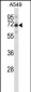 CCDC99 Antibody (C-term)