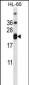 CD3E Antibody (C-term)