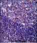 CD5 Antibody (Center)