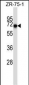 CD5 Antibody (Center)