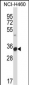 FCGR3A Antibody (C-term)