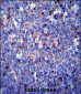 MMP3 Antibody (N-term)