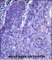 MMP3 Antibody (N-term)