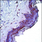 CD1A Antibody (Center)