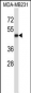 CD1A Antibody (Center)