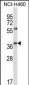 CD33 Antibody (Center)