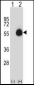 CD33 Antibody (Center)