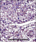 PROC Antibody (Center)