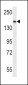 SMC1A Antibody (N-term)