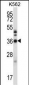 CRKL Antibody (N-term)