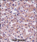 SYT6 Antibody (C-term)