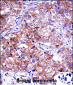 IMPDH1 Antibody (C-term)