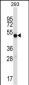 IMPDH1 Antibody (C-term)