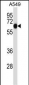 ALPPL2 Antibody (N-term)