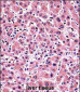 ALPP Antibody (Center)