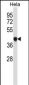 GRINA Antibody (Center)