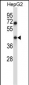 TMEM49 Antibody (C-term)