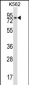 REC8 Antibody (Center)