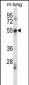 PDCD7 Antibody (C-term)