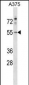 PDCD7 Antibody (C-term)
