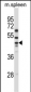 SLC30A6 Antibody (Center)
