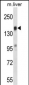 TIAM2 Antibody (N-term)