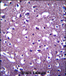 PCDHGA3 Antibody (Center)