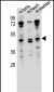 NKD1 Antibody (N-term)