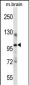 ITCH Antibody (Center)