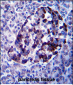 MID2 Antibody (C-term)