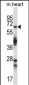 TRIM45 Antibody (C-term)