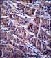 HDAC7 Antibody (C-term)