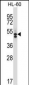 HDAC7 Antibody (C-term)