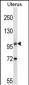 ATG9B Antibody (C-term)