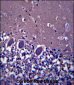 ABHD4 Antibody (Center)