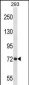 APP Antibody (Center)