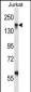 ITGAL Antibody (Center)