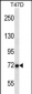 MMP2 Antibody (Center)