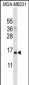 PTH Antibody (Center)