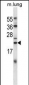 CRYAB Antibody (Center)