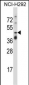 TNFRSF10A Antibody (C-term)