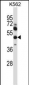 MMP13 Antibody (Center)