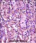 SYT1 Antibody (C-term)