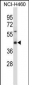 SYT1 Antibody (C-term)